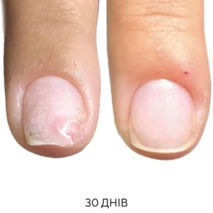 NAILSOFTHEDAY ONISTOP – регенеруюча олія проти оніхолізису, 15 мл